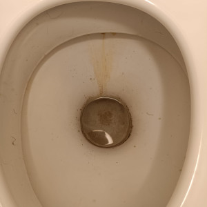 Photo de galerie - Avant intervention – Forte accumulation de calcaire et de dépôts incrustés dans la cuvette. Une remise en état approfondie est nécessaire pour retrouver un résultat propre et sain.