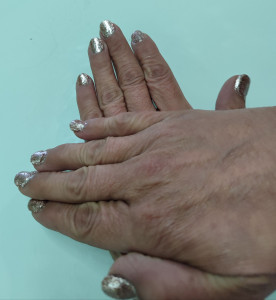 Photo de galerie - Pose capsules 