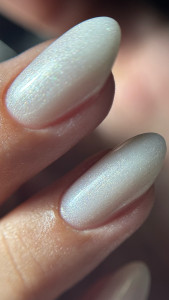 Photo de galerie - Remplissage gel