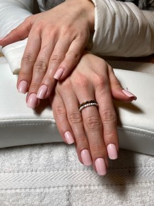 Photo de galerie - Prothésiste angulaire à Aussonne