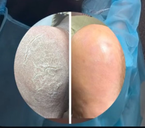 Photo de galerie - Soins des pieds 