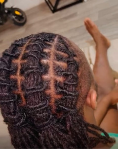 Photo de galerie - Resserrage locks 