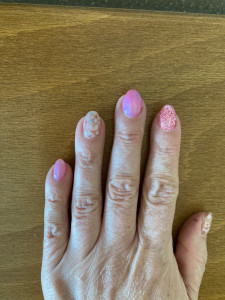 Photo de galerie - Ongles en gel 