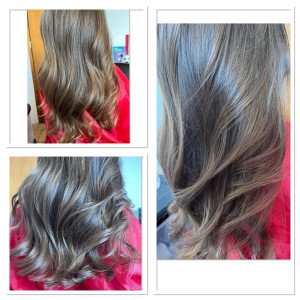 Photo de galerie - Soin botox