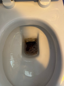 Photo de galerie - Toilettes ultra entartrées ? n’attendez plus appelez SG&Co Nettoyage 