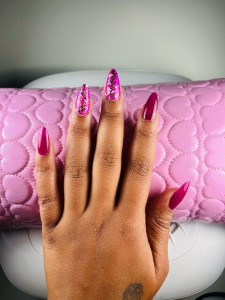 Photo de galerie - Pose de capsules américaine 