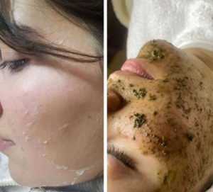 Photo de galerie - Peeling bio organic 