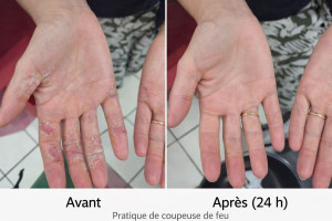 Photo de galerie - Avant et après soins 