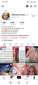 Photo de galerie - Retour sur soin 
Brûlure 3eme degré 
Poussée psoriasis 