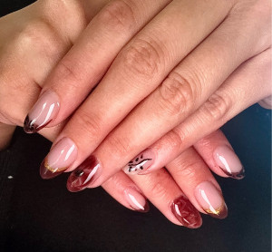 Photo de galerie - Gel