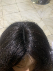 Photo de galerie - Pose greffe 