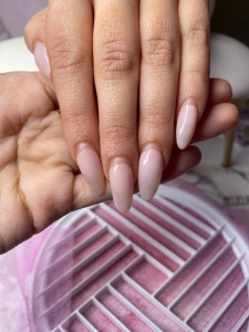 Photo de galerie - Dépose après 1 mois