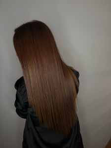 Photo de galerie - Soin botox 