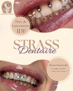 Photo de galerie - Strass dentaires 