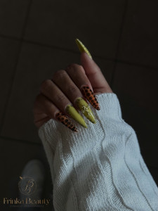 Photo de galerie - Pose américaine 