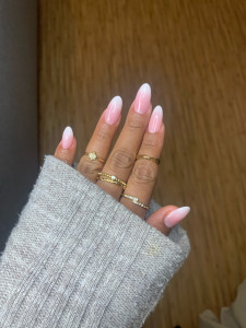 Photo de galerie - Rallongement demi-capsule 